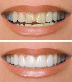 Cosmetic Dentistry Services